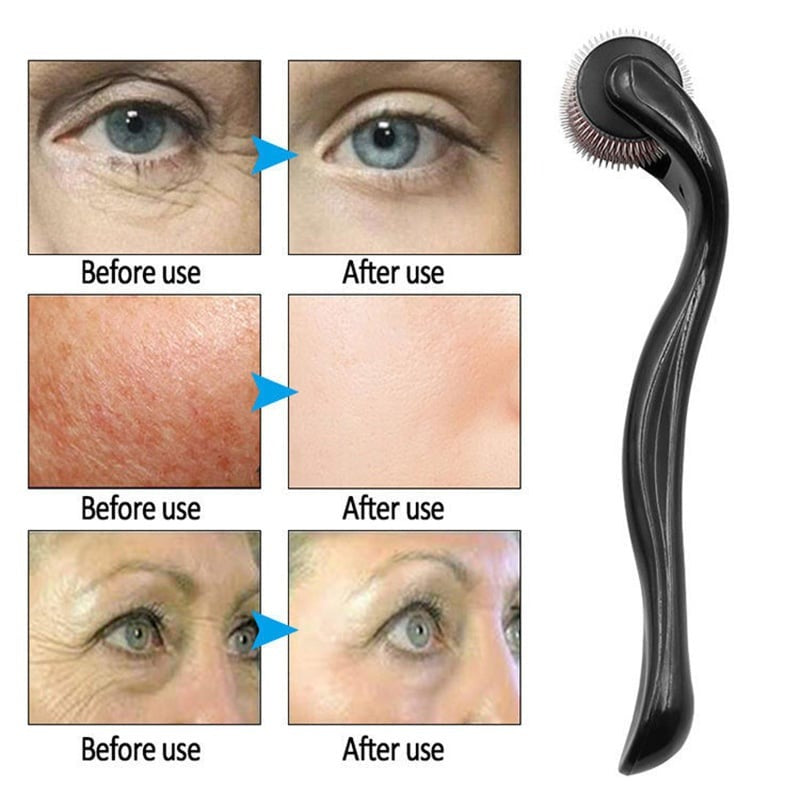 540 Titanium Derma Roller – Hair Growth, Beard & Facial Skin Care Naturally